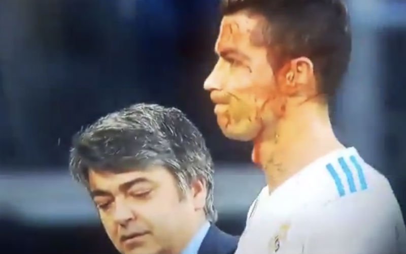 Cristiano Ronaldo scoort, bloedt en doet dan dit (Video)