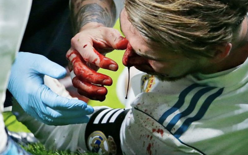 Verschrikkelijke blessure voor Sergio Ramos